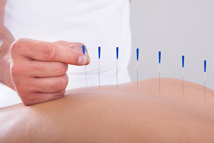 Acupuncture - Physiomotive Physiotherapy Center